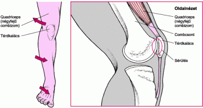 fájdalom a lábban és térdben)