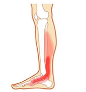 A lábfej és a boka arthrosisa